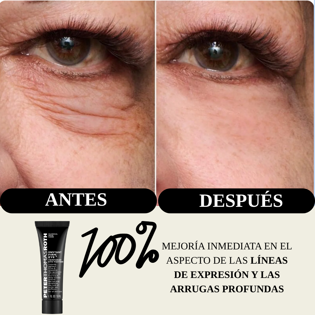 Mirada Lift™ - Peter Thomas Roth